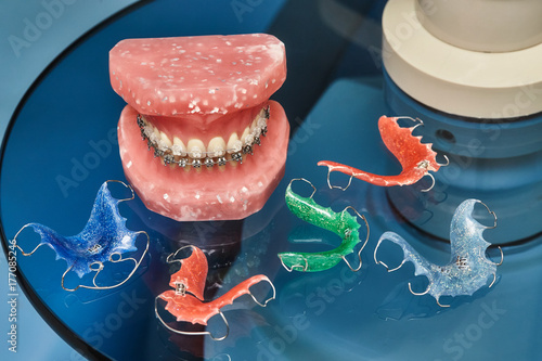 Human jaw or teeth model with metal wired dental braces