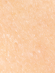Human skin as a background.