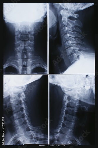 Fait mal les reins à gauche rend par derrière au ventre