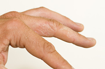 Wenn Die Linke Hand Juckt Wenn Die Linke Hand Juckt