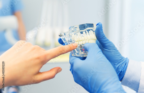 Zdjęcia close up of dentist hands with teeth or jaw model