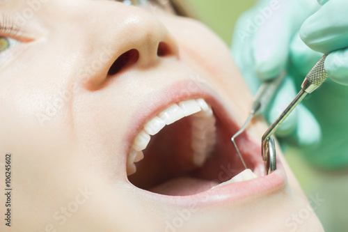 Zdjęcia Woman teeth close up dentist check