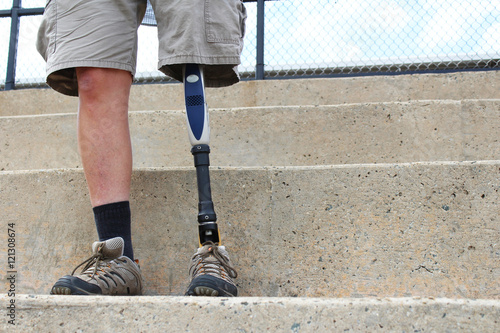 Standing man with prosthetic leg, detail