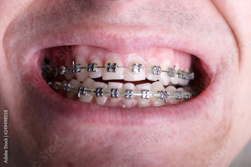Ugly Teeth Best Teeth Wallpaper