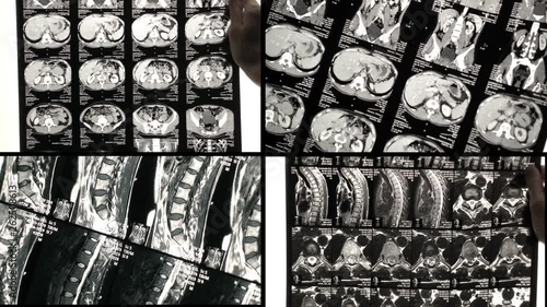 The doctor's see problem areas of the back on the MRI Scan or X-Ray. © DmytroKos